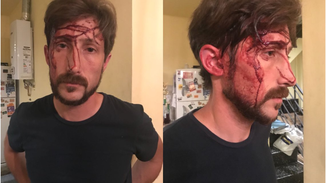 Repudio al ataque contra el concejal Hernán Lechter